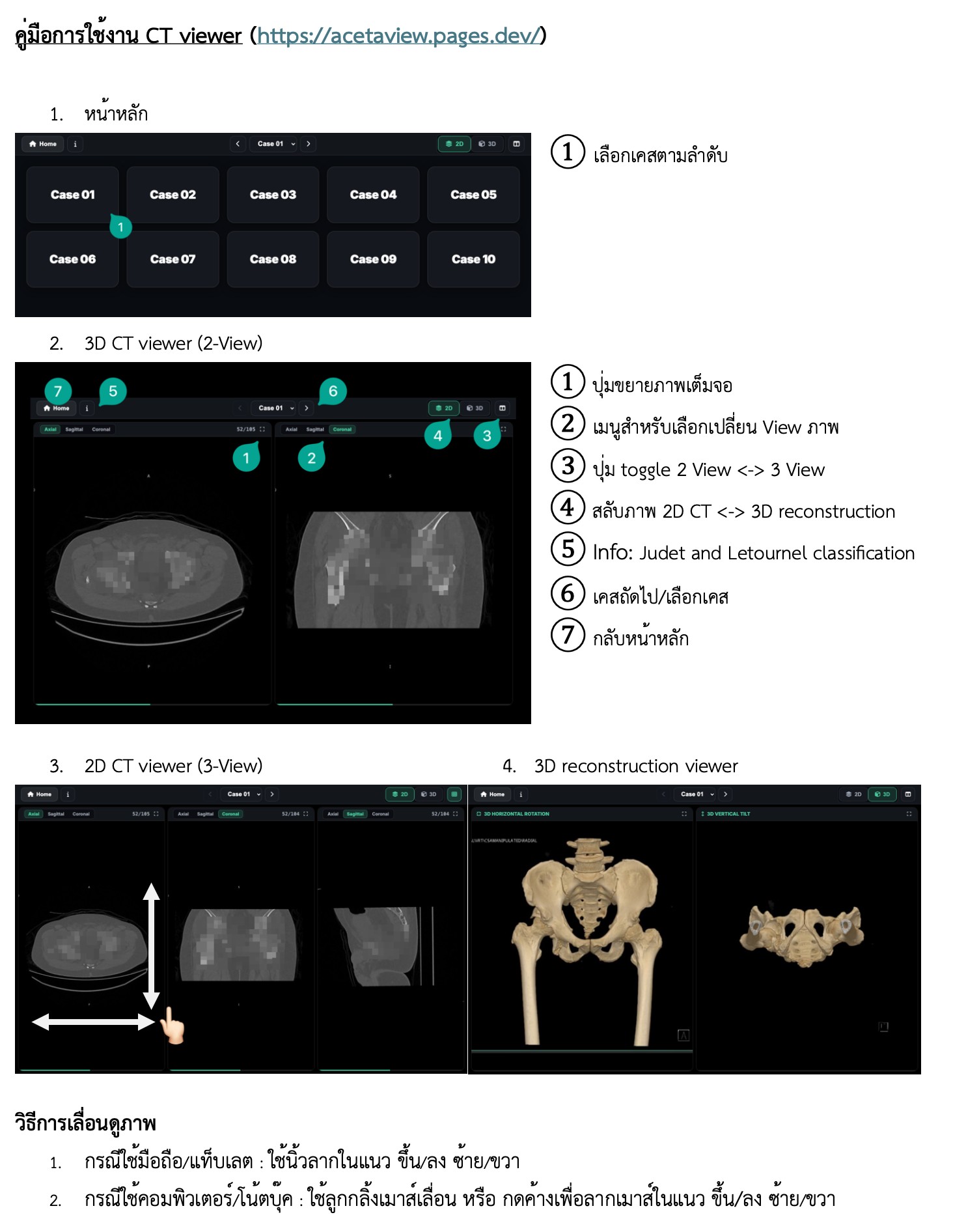 คู่มือการใช้งาน CT Viewer
